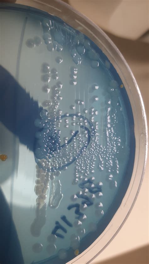 proteus mirabilis|proteus mirabilis jaki antybiotyk.